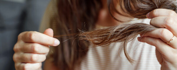 perte de cheveux