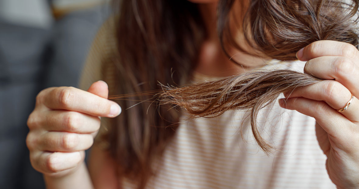 perte de cheveux